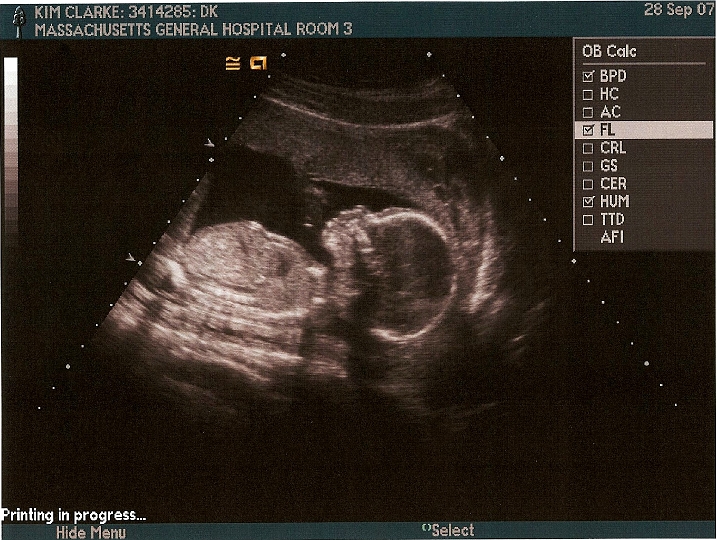 Ultrasounds_005b.jpg - It's a...