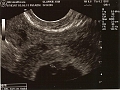 Ultrasounds_01